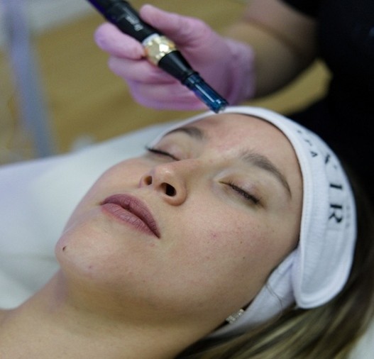 Microneedling + Pink Glow 