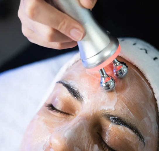 Radiofrequency Facial