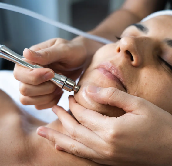 Microdermabrasion