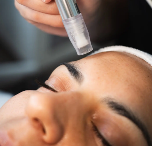 Collagen Induction Therapy 